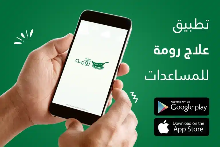 علاج روما